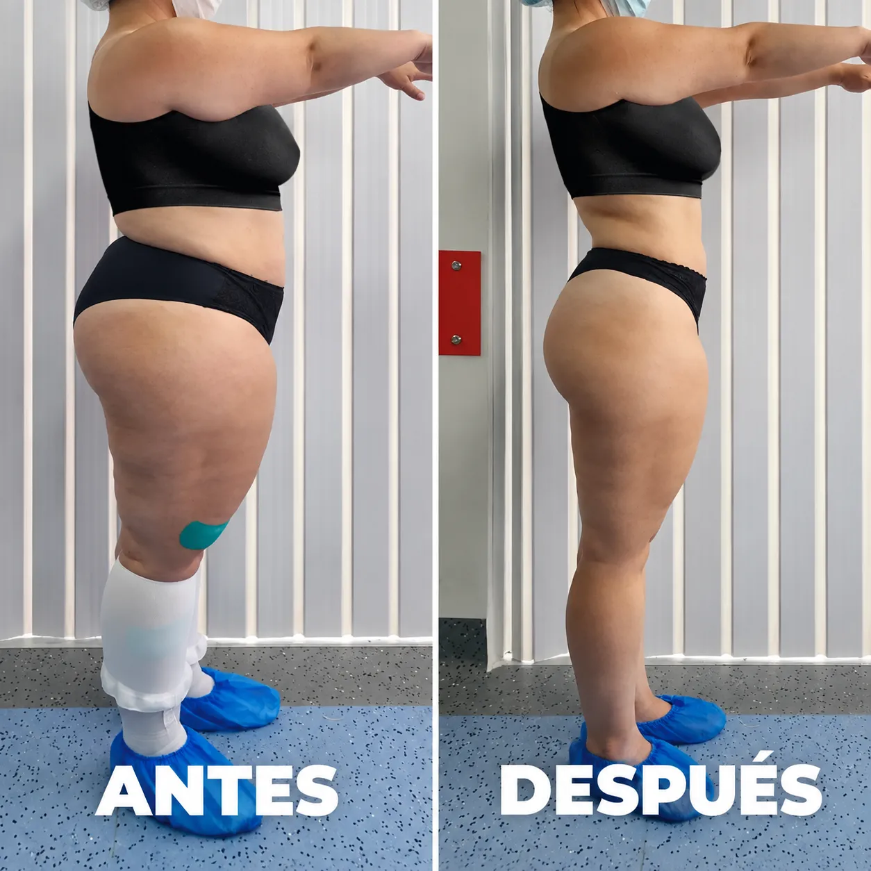 Antes y después — vista 2