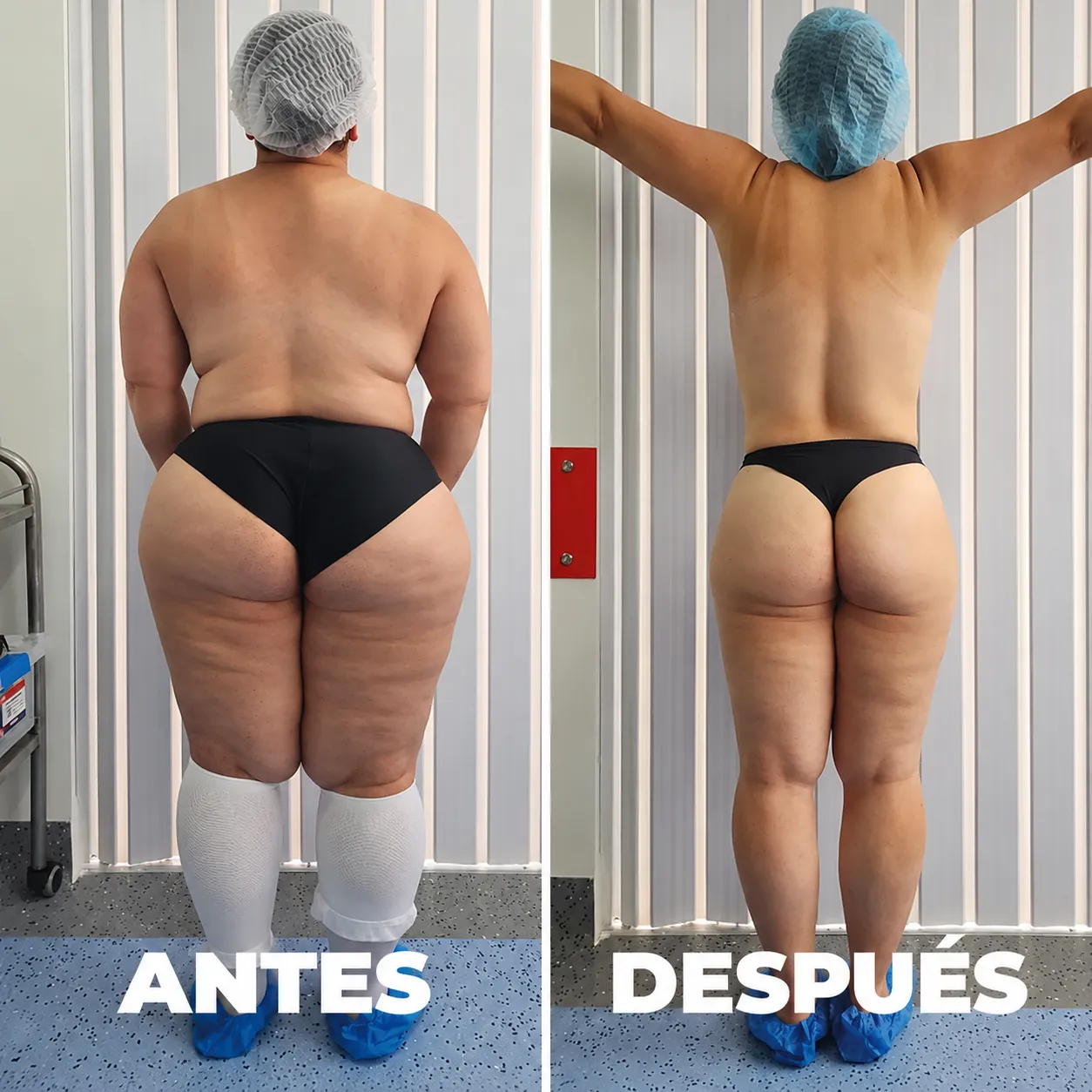 Antes y después — vista 3