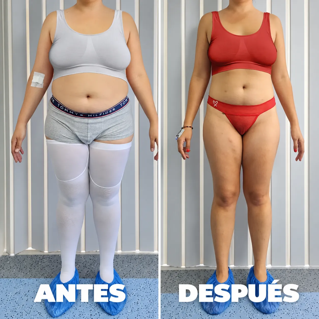 Antes y después — vista 1