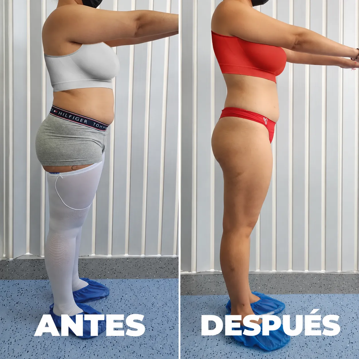 Antes y después — vista 2