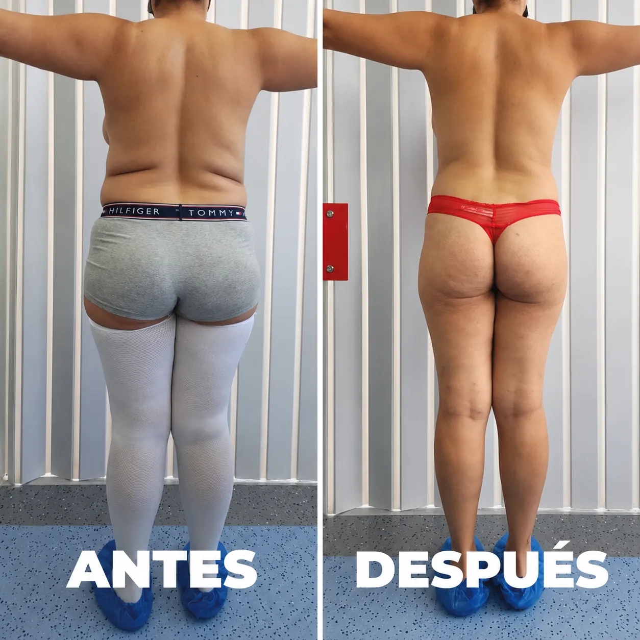 Antes y después — vista 3