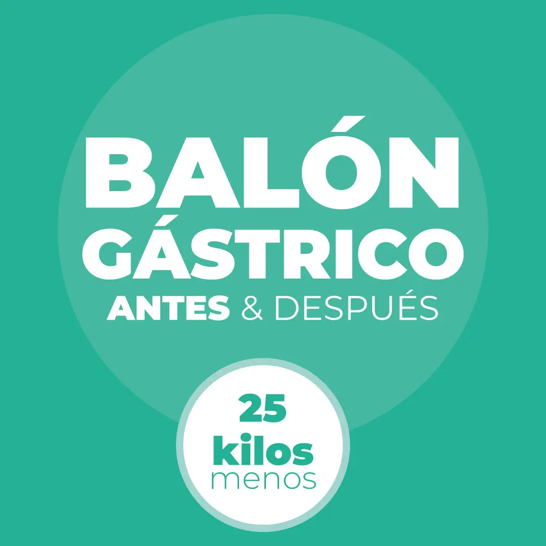 Portada del resultado del paciente — balón gástrico